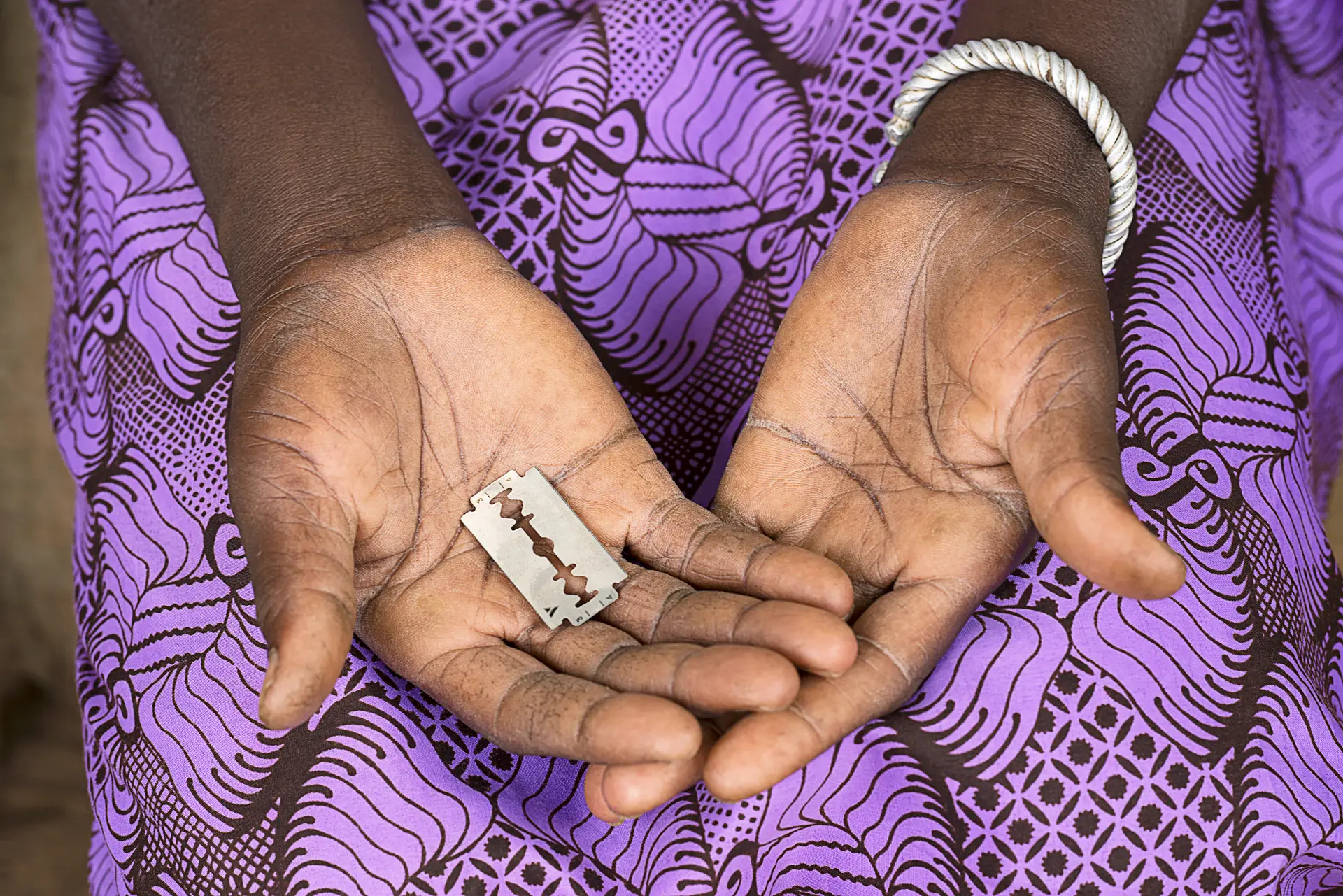 Registados 190 casos de mutilação genital feminina em 2022