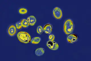 Há um 'superbug' a preocupar os EUA: casos de Candida auris registaram “crescimento anormal”