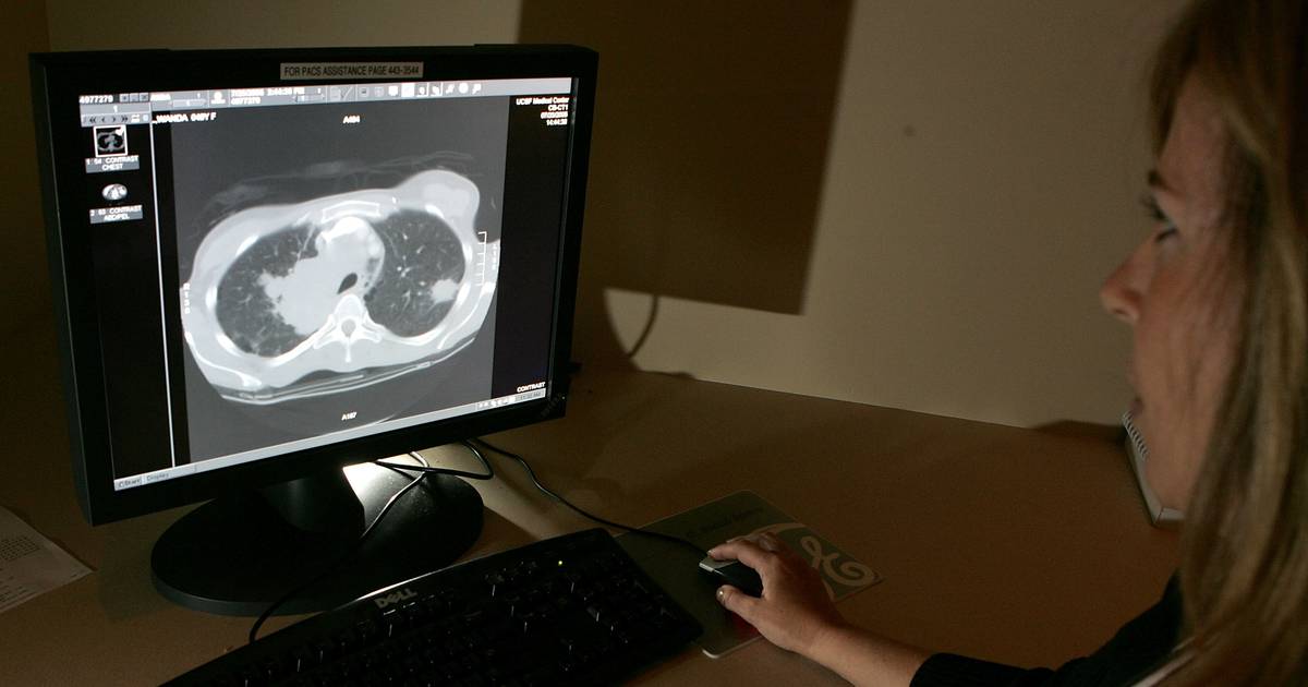 Governo deixou fechar linha de financiamento europeu para rastreio do cancro pulmão