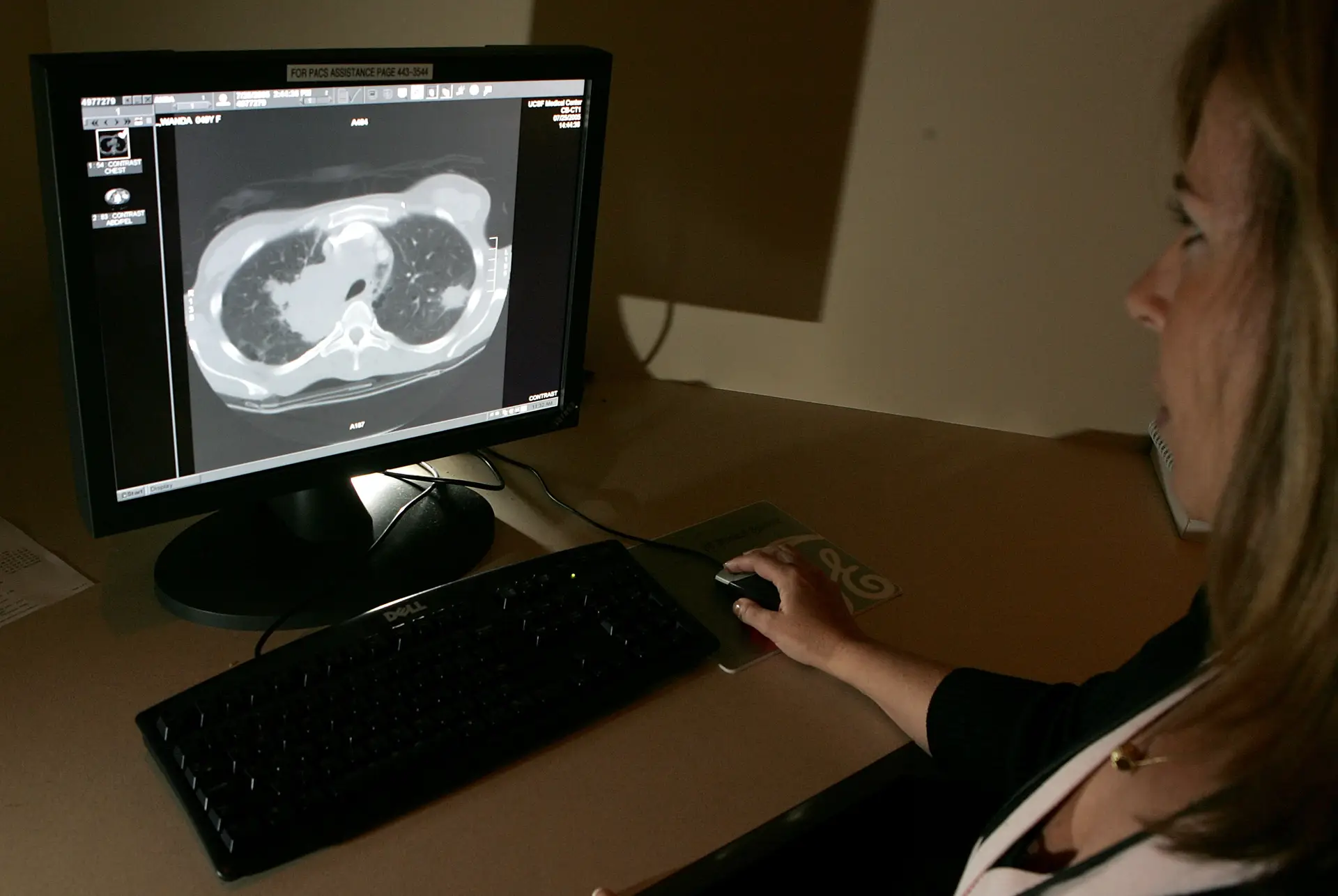 Sinais de cancro podem ser detetados anos antes dos sintomas