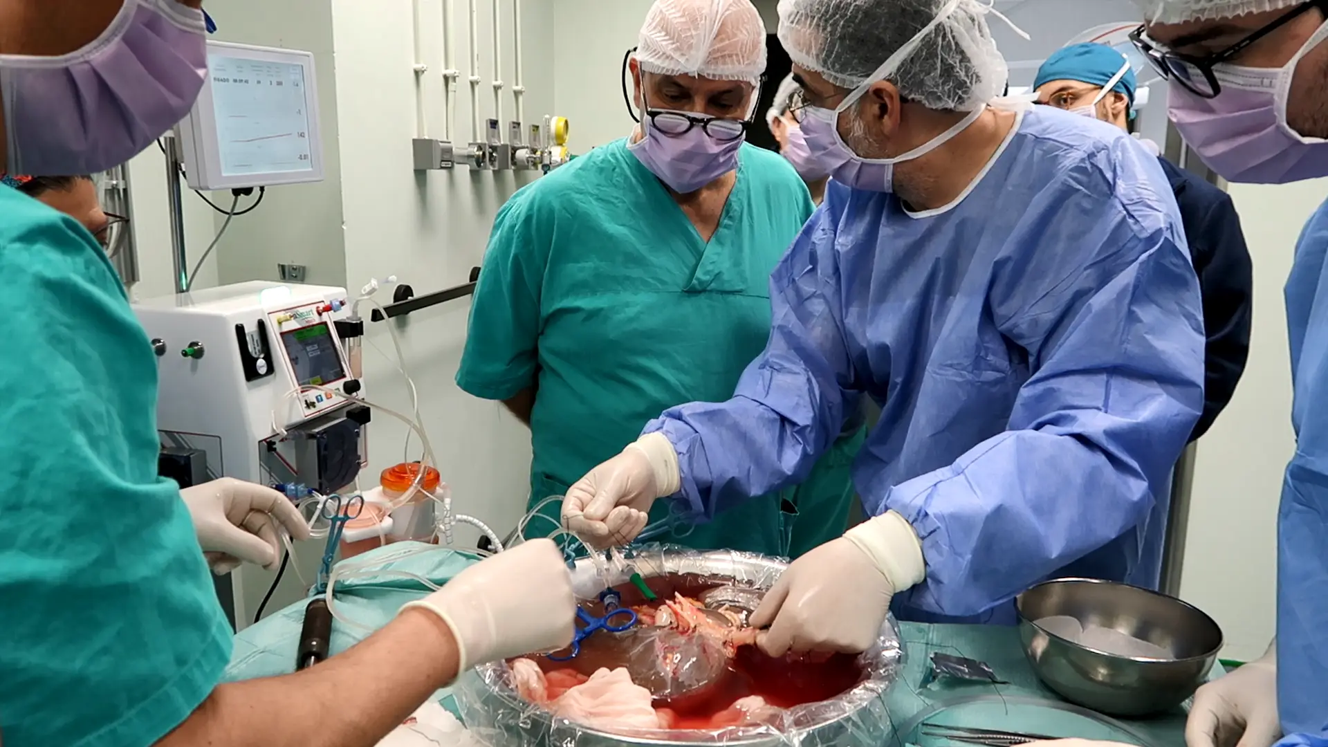 Os cirurgiões do Hospital Curry Cabral, de Lisboa, tornaram-se pioneiros europeus de transplante de fígado inteiro com robôs 