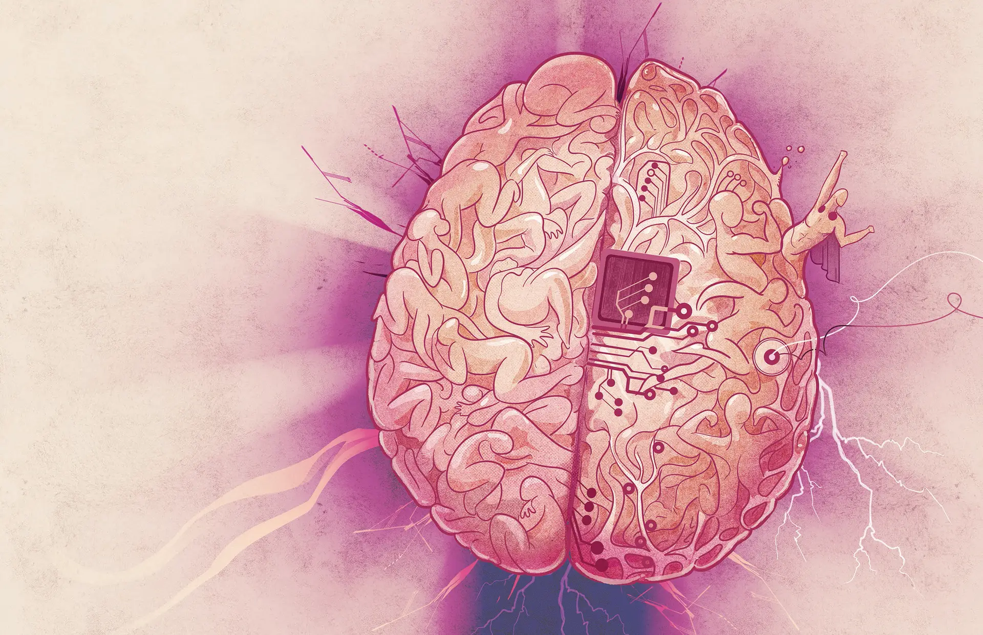 A tecnologia dos implantes está a redefinir as fronteiras do nosso cérebro