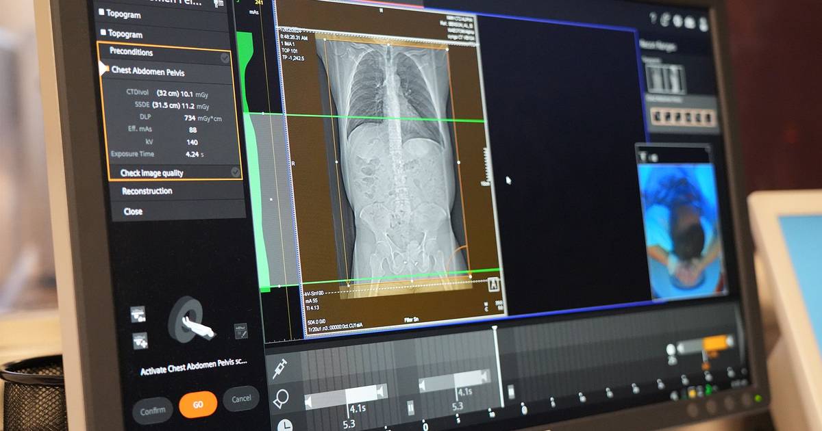 Oncologistas choraram com tratamento que duplica tempo de vida e reduz risco de morte no cancro do pâncreas