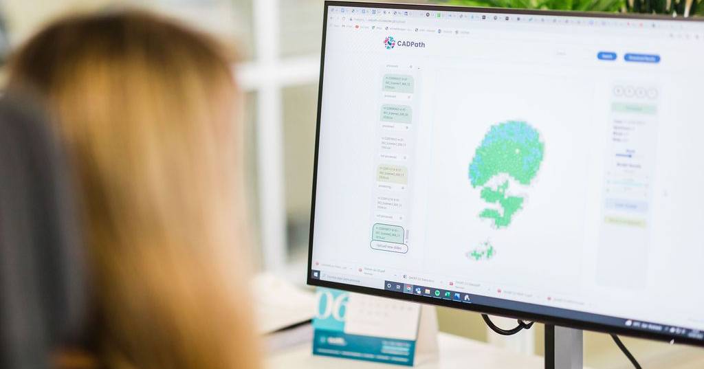 Para evitar a “ansiedade quando estamos à espera de um exame”, há uma ferramenta digital que analisa rapidamente possíveis casos de cancro