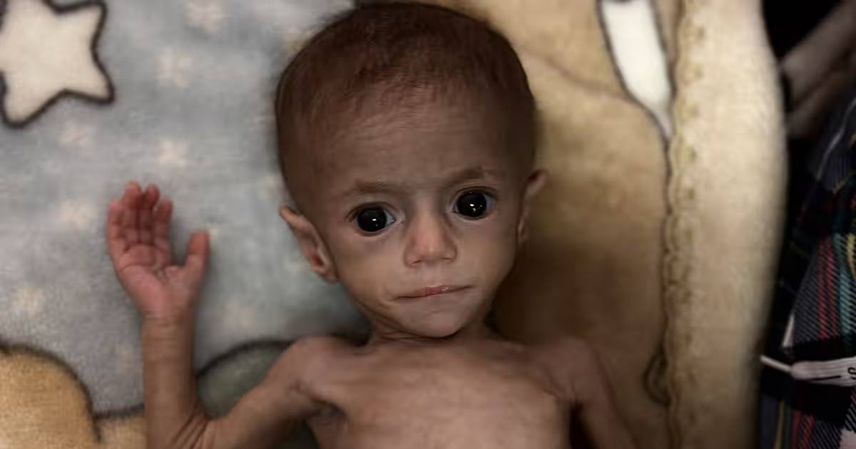 Estão a matar crianças à fome em Gaza, porque não queremos saber?