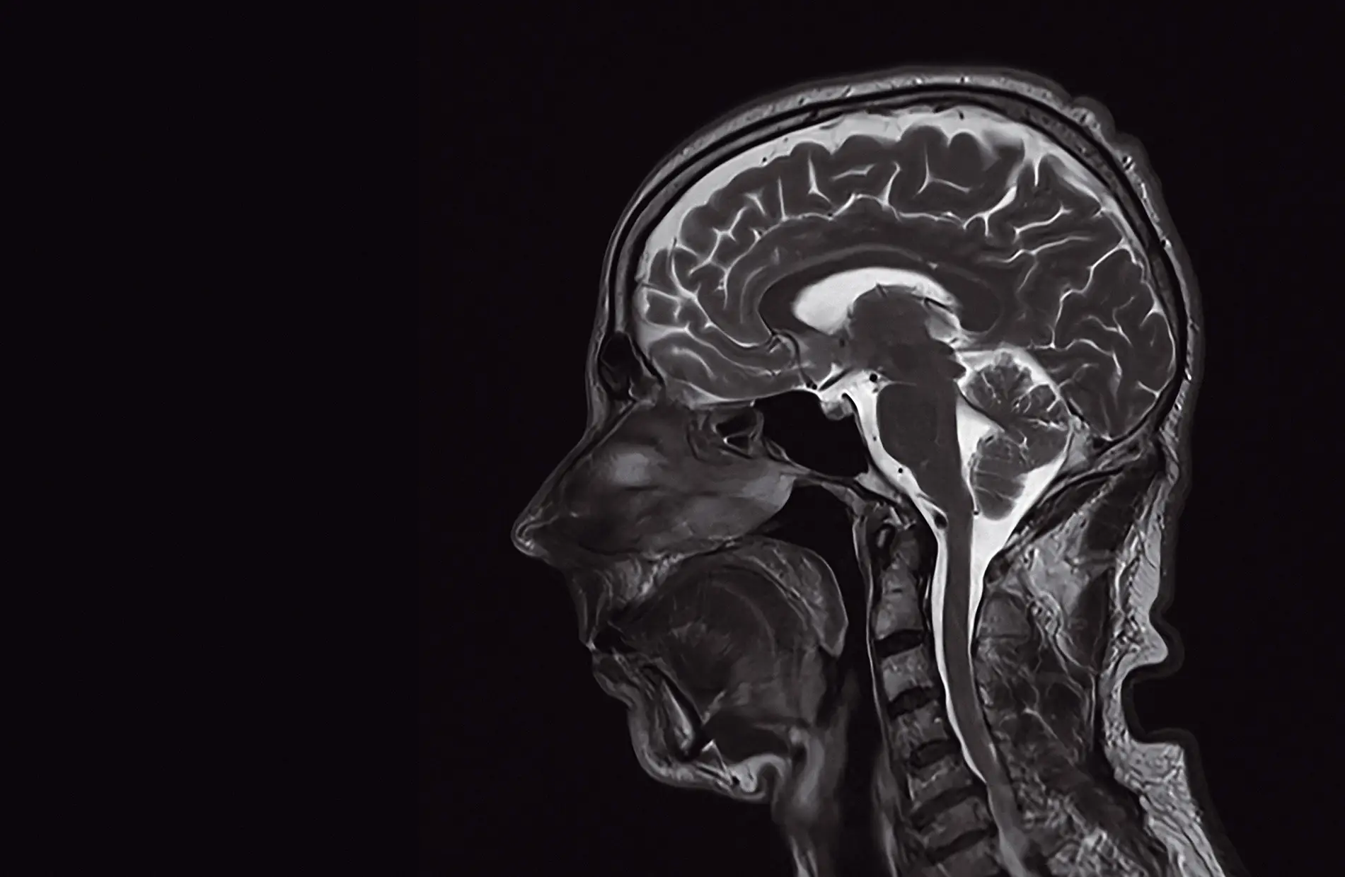 O cérebro é um dos órgãos analisados ao pormenor no full-body scan, que olha, também, para o abdómen, o tórax e os órgãos genitais