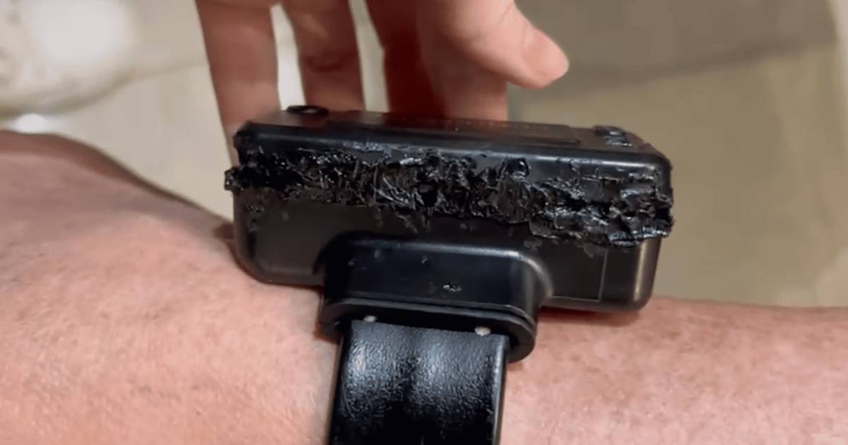 “Meti um ferro quente aí”: Bolsonaro diz que tentou abrir pulseira eletrónica por “curiosidade”