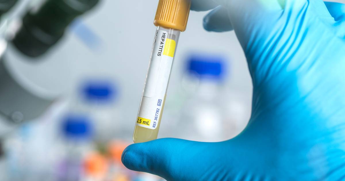 Casos de hepatite A aumentaram 265% em Portugal