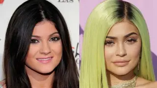 A evolução de Kylie Jenner