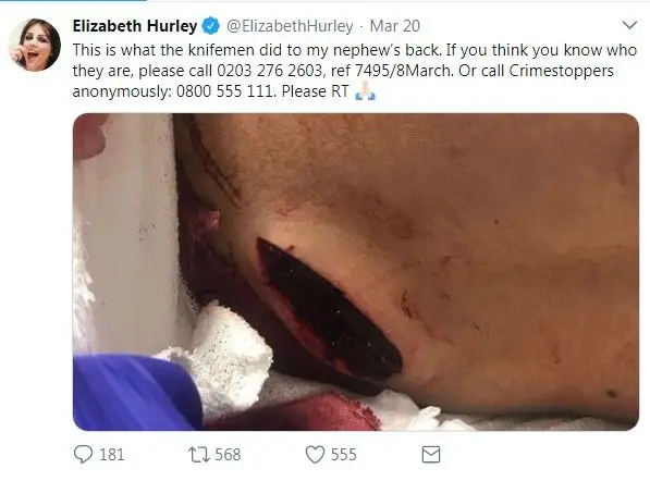 Elizabeth Hurley choca fãs com fotografia do sobrinho esfaqueado