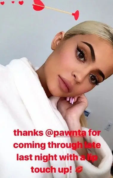 Kylie Jenner não resiste e volta a fazer procedimentos estéticos