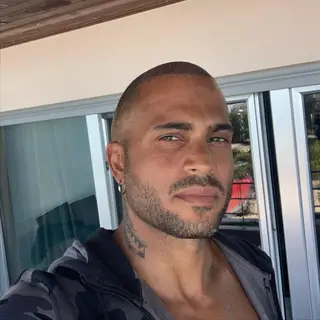 Guillaume Lalung submeteu-se a procedimento estético