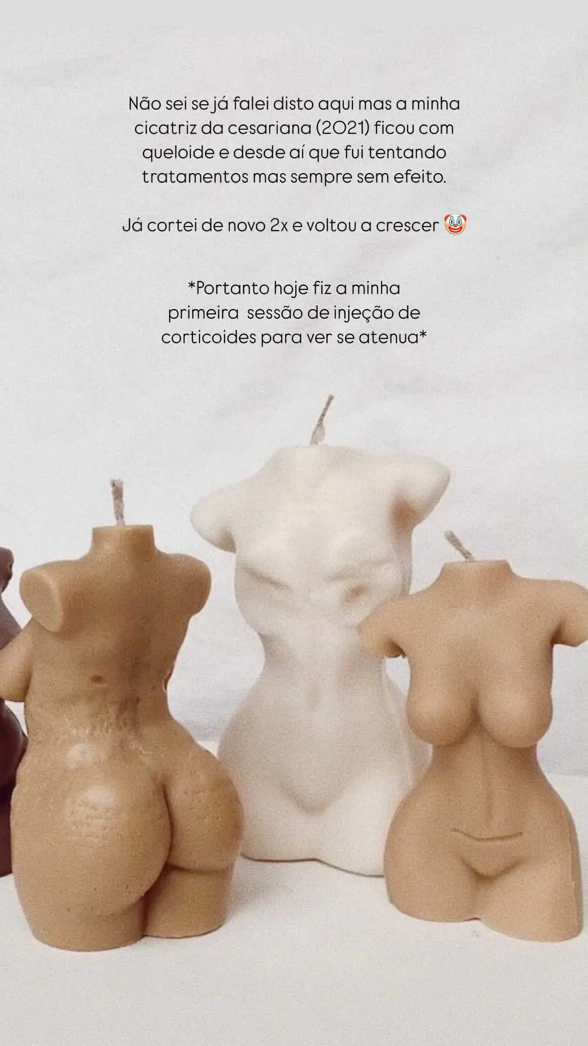 Rita Patrocínio fala sobre a sua "cicatriz de cesariana": "Ficou com queloide. Já cortei 2 vezes"