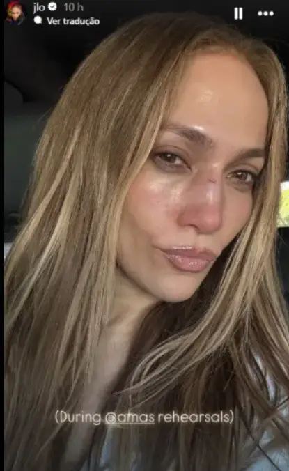 Jennifer Lopez revela ferimento no rosto após pequeno 'acidente': "Isto aconteceu"