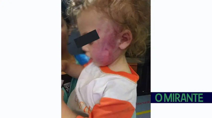 Bebé espancado pelo padrasto em Vila Franca de Xira Bebé espancado pelo padrasto em Vila Franca de Xira
