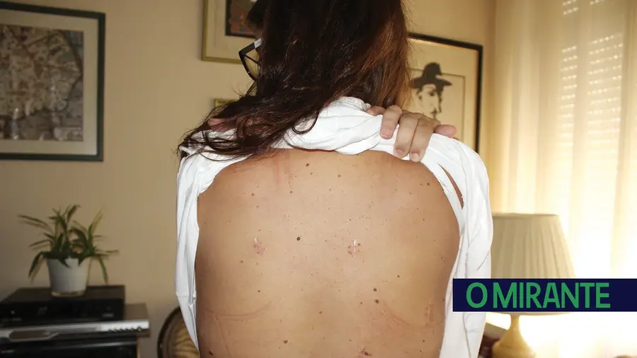 Esfaqueada na via pública depois de apresentar 12 queixas por violência doméstica Esfaqueada na via pública depois de apresentar 12 queixas por violência doméstica