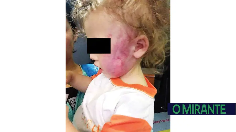Caso do bebé agredido em Vila Franca de Xira segue para o Tribunal de Família e Menores Caso do bebé agredido em Vila Franca de Xira segue para o Tribunal de Família e Menores