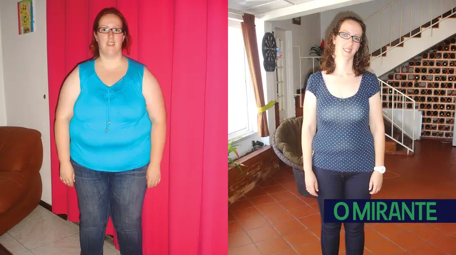 Liliana Silva perdeu 65 quilos após operação de redução de estômago 