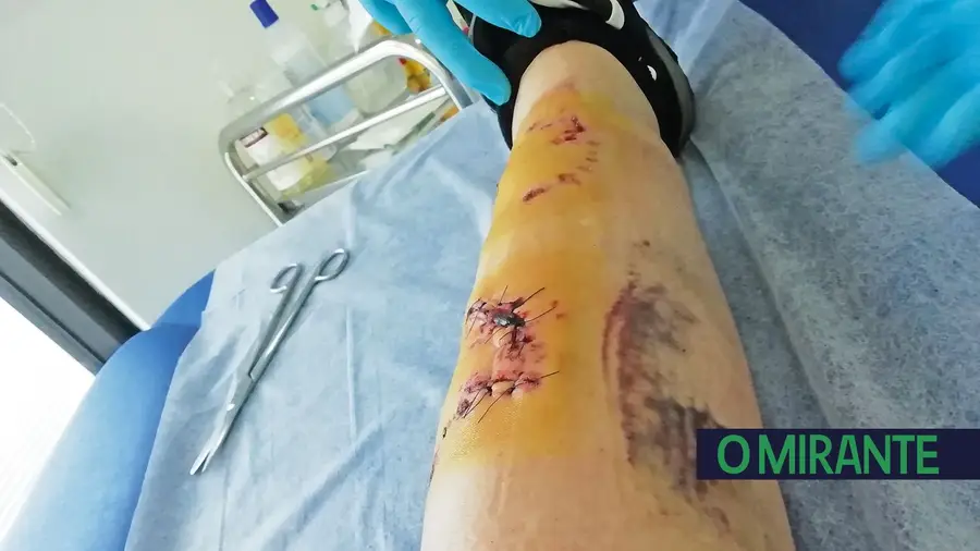 Funcionárias do Hospital CUF Santarém atacadas por cães de raça perigosa Funcionárias do Hospital CUF Santarém atacadas por cães de raça perigosa