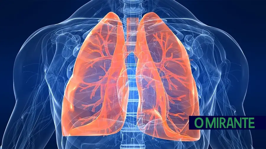 Campanha da Pulmonale alerta para estigmatização de doentes com cancro do pulmão Campanha da Pulmonale alerta para estigmatização de doentes com cancro do pulmão