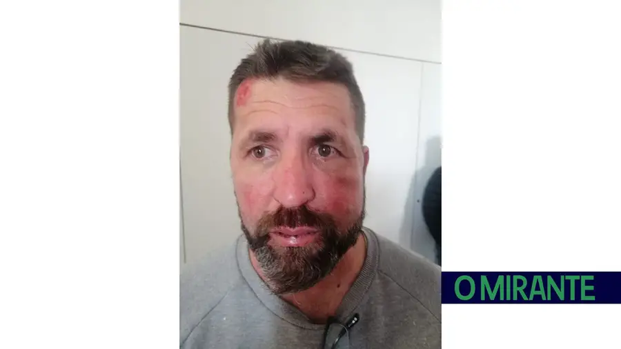 Vasco Filipe diz que foi agredido com violência por militar da GNR Vasco Filipe diz que foi agredido com violência por militar da GNR