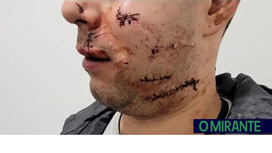 Militar da GNR de Alcanena agredido brutalmente junto a discoteca em Tomar