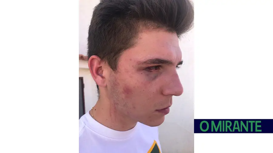 Militar da GNR novamente suspeito de envolvimento em agressões violentas Militar da GNR novamente suspeito de envolvimento em agressões violentas