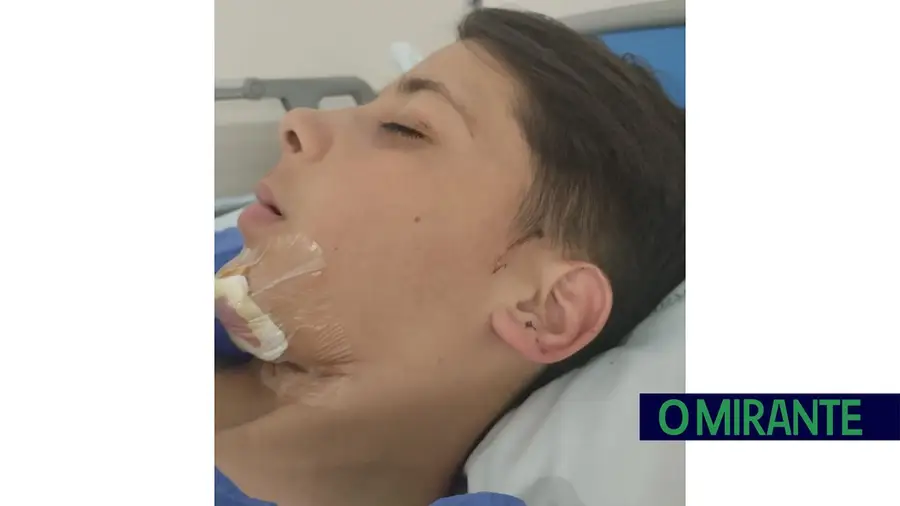 Aluno agredido com golpe mata-leão durante visita de estudo a Santarém Aluno agredido com golpe mata-leão durante visita de estudo a Santarém