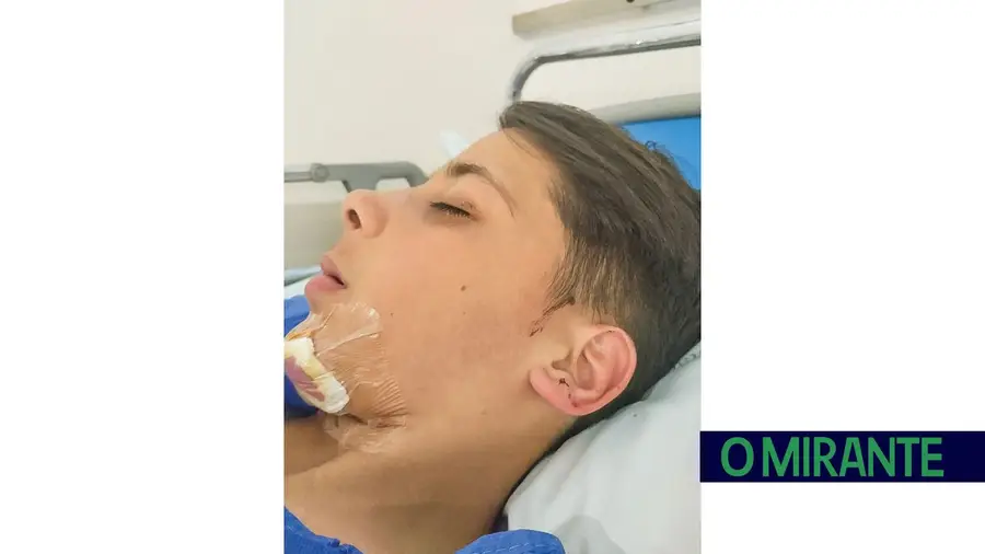 Aluno agredido durante visita de estudo a Santarém teve de receber assistência hospitalar Aluno agredido durante visita de estudo a Santarém teve de receber assistência hospitalar