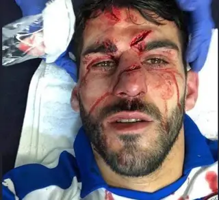 “O Tyrone Mings pisou-me a cara de propósito e mandei a foto para o grupo WhatsApp dos colegas: ‘Continuo mais bonito que vocês’. Sou durão”