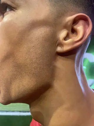 Pormenor da face de Cristiano Ronaldo, onde é possível ver os furos nas orelhas e até manchas provocadas pela acne