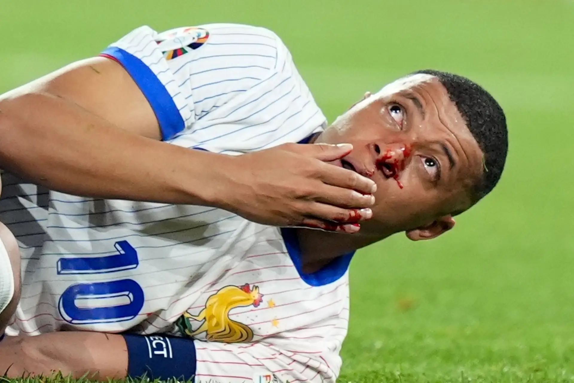 Alguém tem uma máscara por aí? Mbappé partiu o nariz e vai precisar de uma para jogar