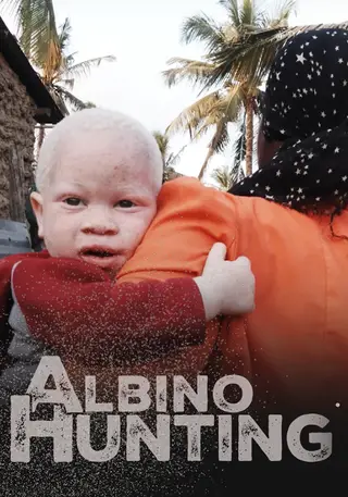 ALBINO HUNTING
