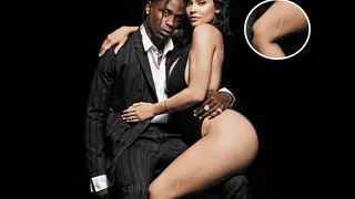 Sem complexos, Kylie Jenner conta como fez a cicatriz na perna
