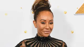 O que aconteceu ao rosto de Mel B?