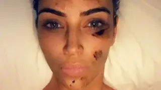 Doença deixa Kim Kardashian praticamente irreconhecível