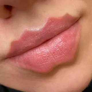 Boca de 'diabo': a nova tendência estética que está a alarmar os médicos