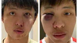 Jovem estudante espancado em Londres por causa do Coronavírus