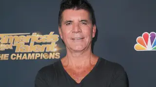 Graças às operações plásticas Simon Cowell ficou com uma expressão facial "triste"