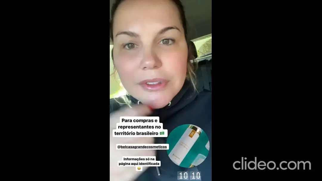 Katia Aveiro assume botox no rosto e fala de preconceito: “Parem de julgar as pessoas”