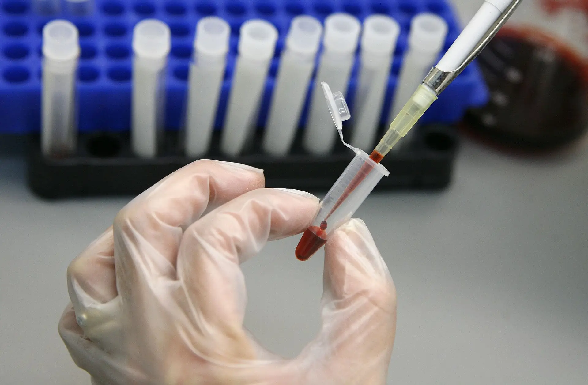 DGS apela para realização de testes de VIH, hepatites e infeções sexualmente transmissíveis