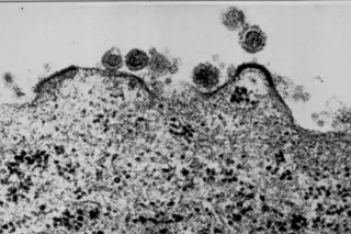 Células de leucemia resistem à quimioterapia porque movem-se rapidamente na medula