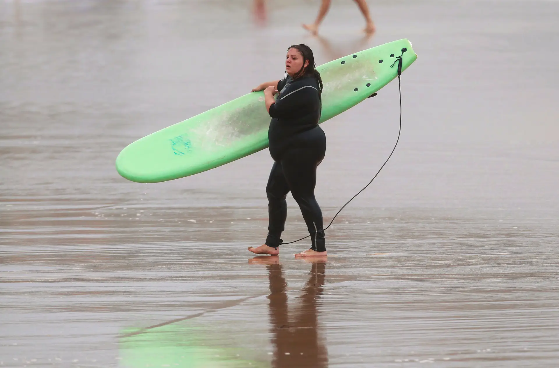 Bactérias dos intestinos revelam grau de obesidade