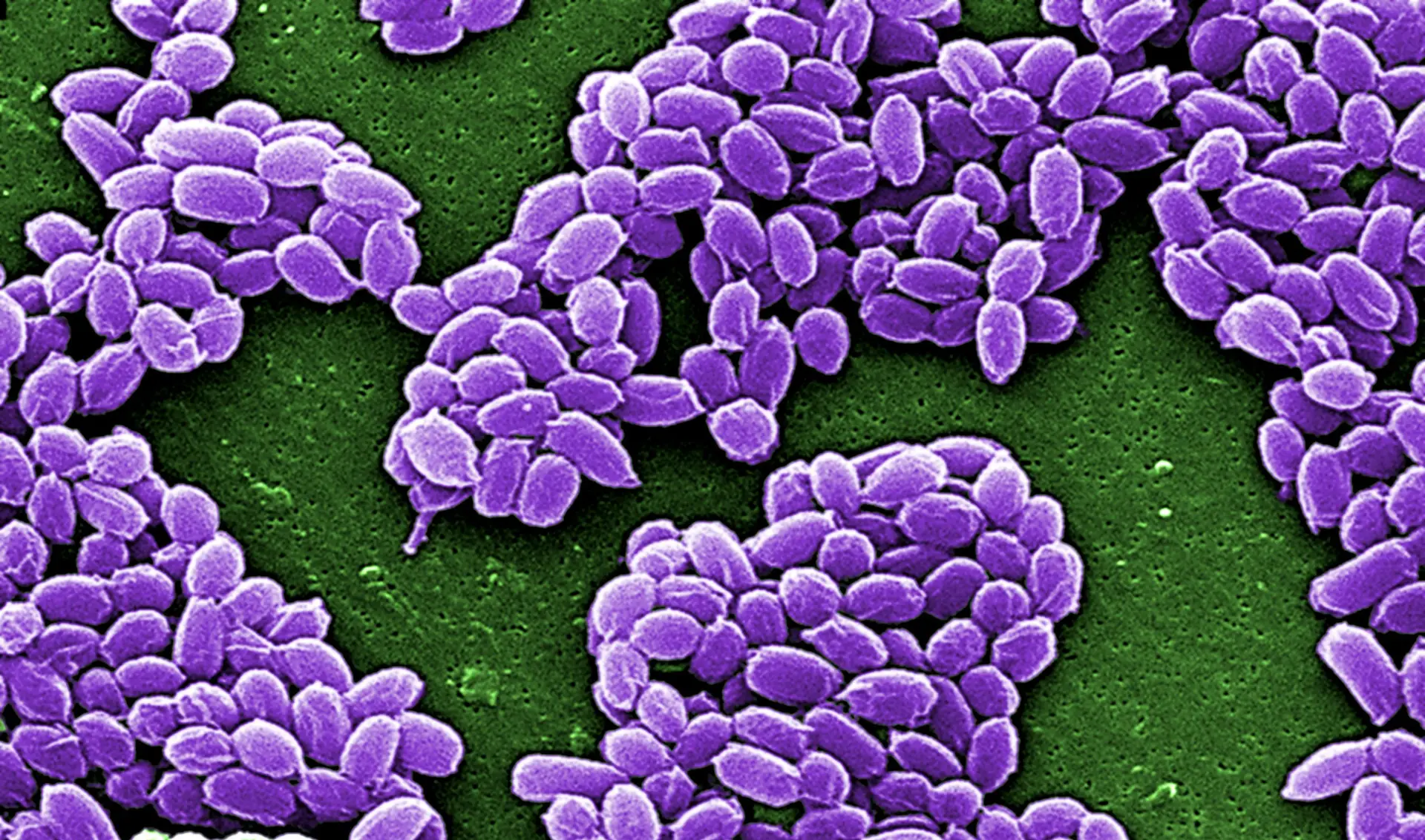 O antibiótico que promete matar as bactérias mais resistentes