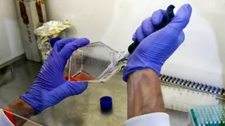 Mutações em enzima estão associadas a mau prognóstico do cancro da pele