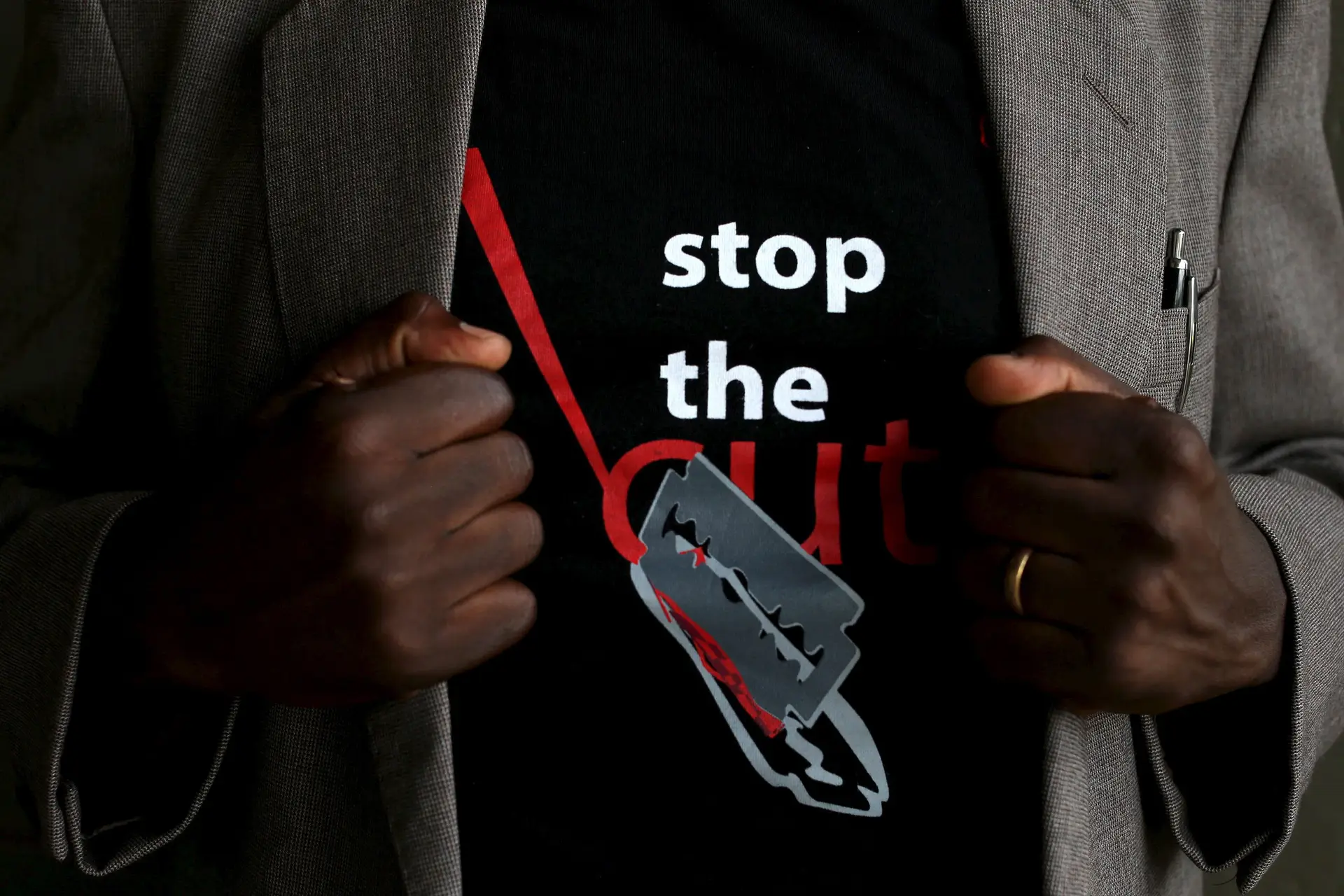 Bruxelas reafirma compromisso europeu de erradicar mutilação genital feminina