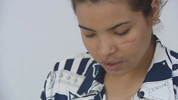 Partidos exigem explicações após agressão a jovem colombiana