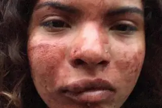 "Preta, tu aqui não entras". O relato da jovem colombiana agredida no Porto