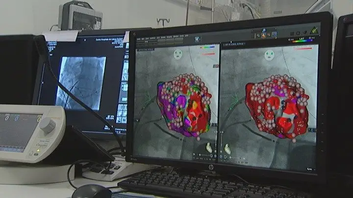 Fármaco dado na primeira hora reduz risco de morte de doentes com insuficiência cardíaca