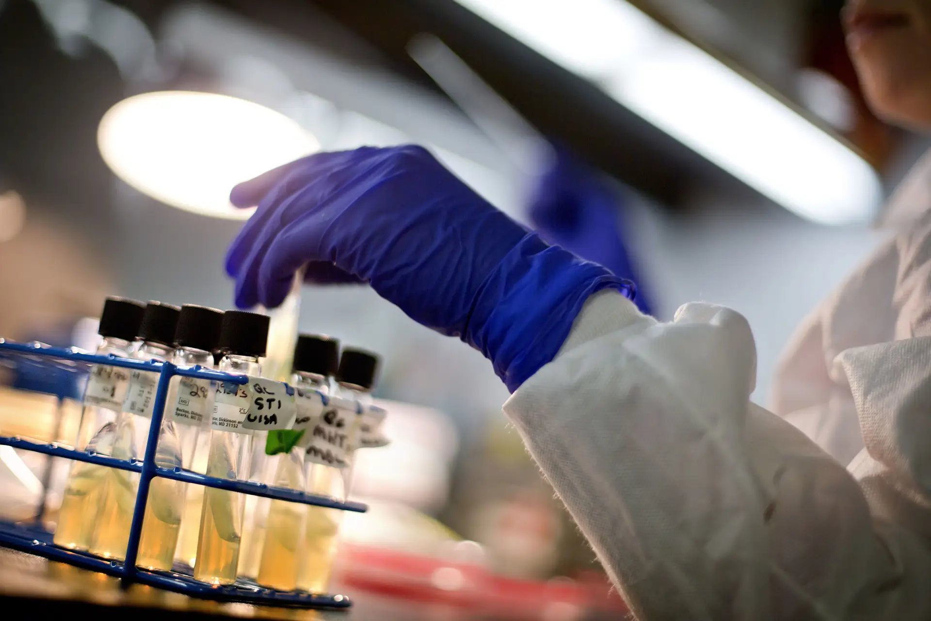 Portugal é o 4º país da UE com mais danos por infecções por bactérias resistentes